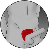 Viper Estim Cock Ring