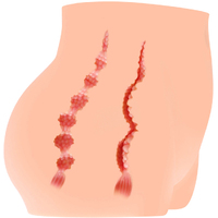 Cherry Mini Hip + Pussy